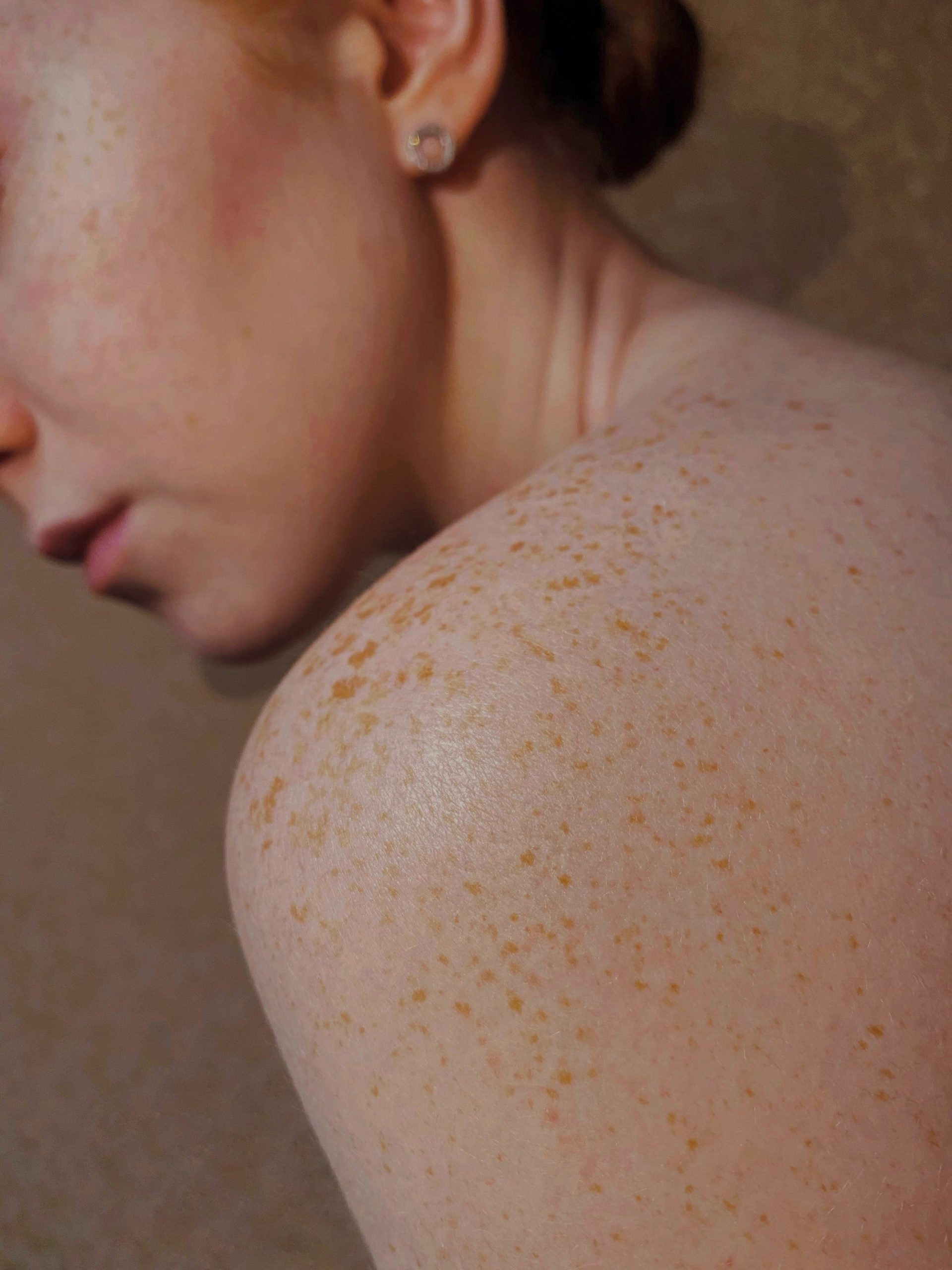 Acupuncture for Clear Skin