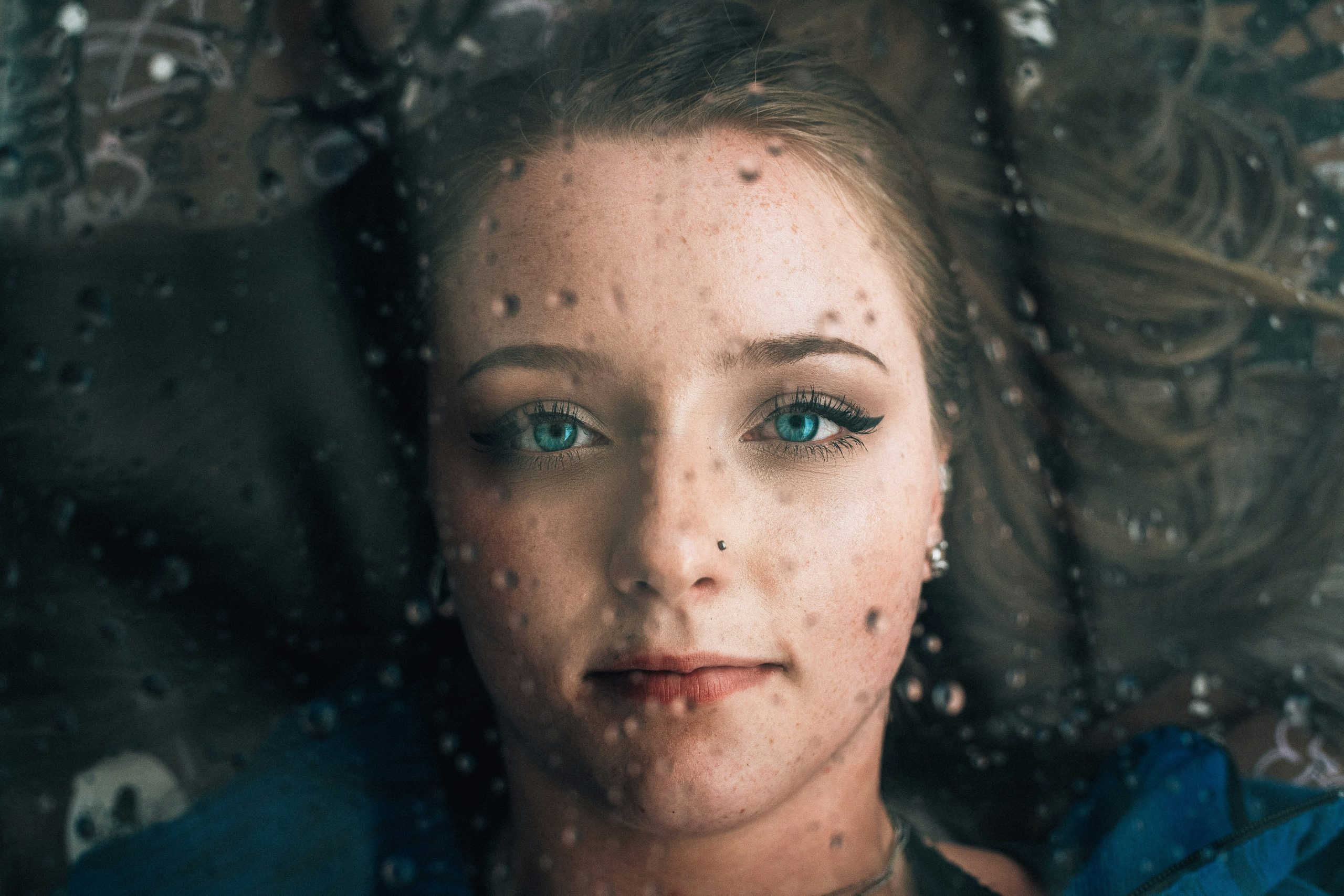 Cosmetic Acupuncture